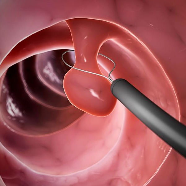 Cirugía Endoscópica