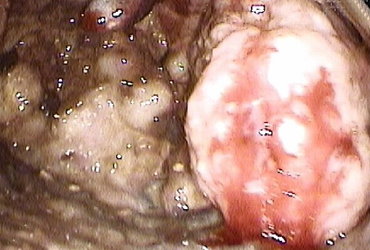 Dr Gaspar Farias Marín