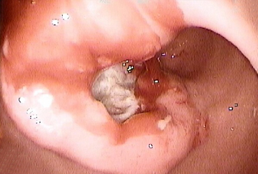 Dr Gaspar Farias Marín